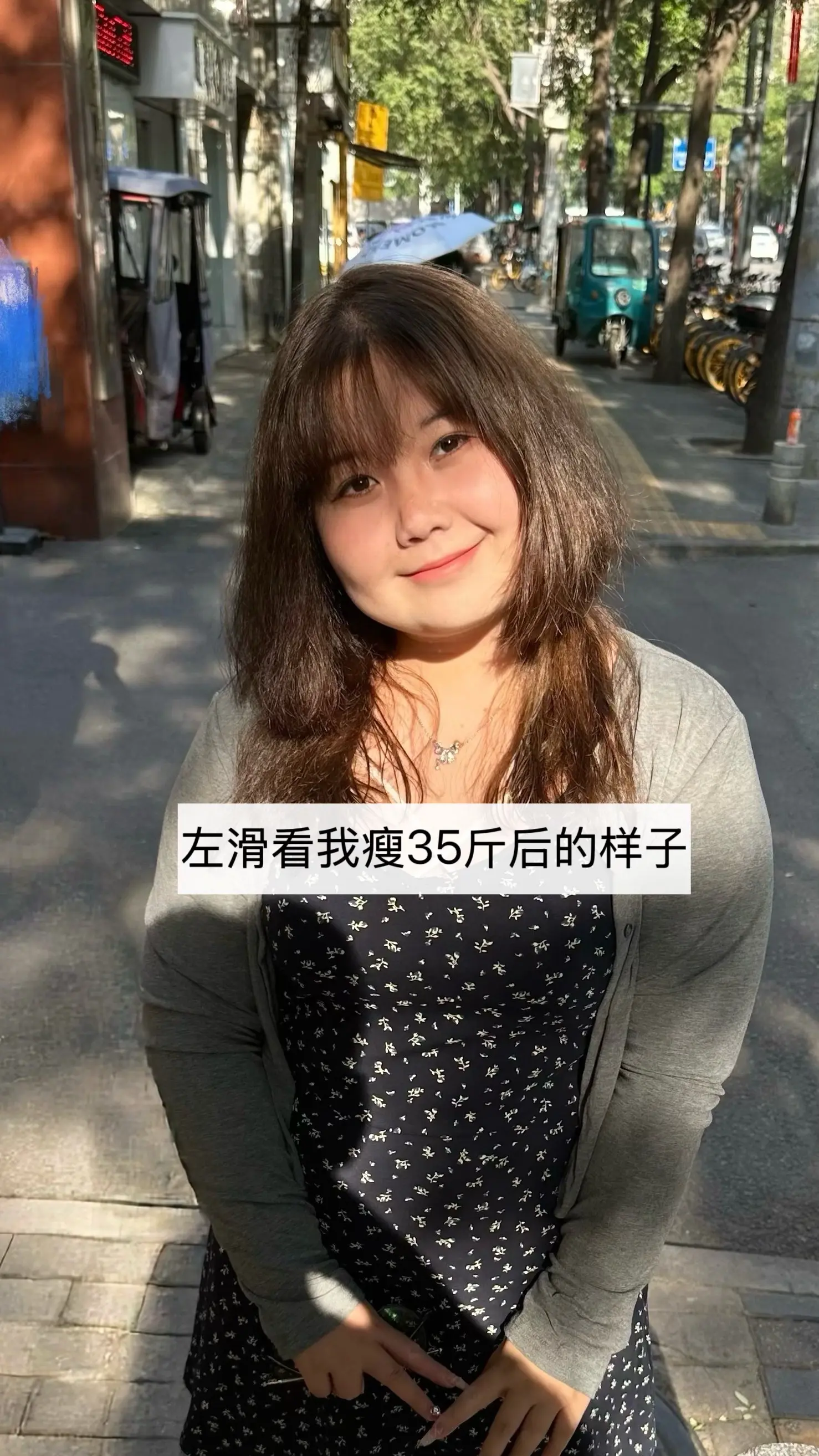 减肥真是最好的医美了……