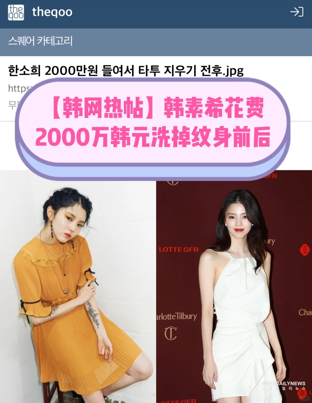 🔥韩网热帖｜韩素希花2000万洗掉纹身前后