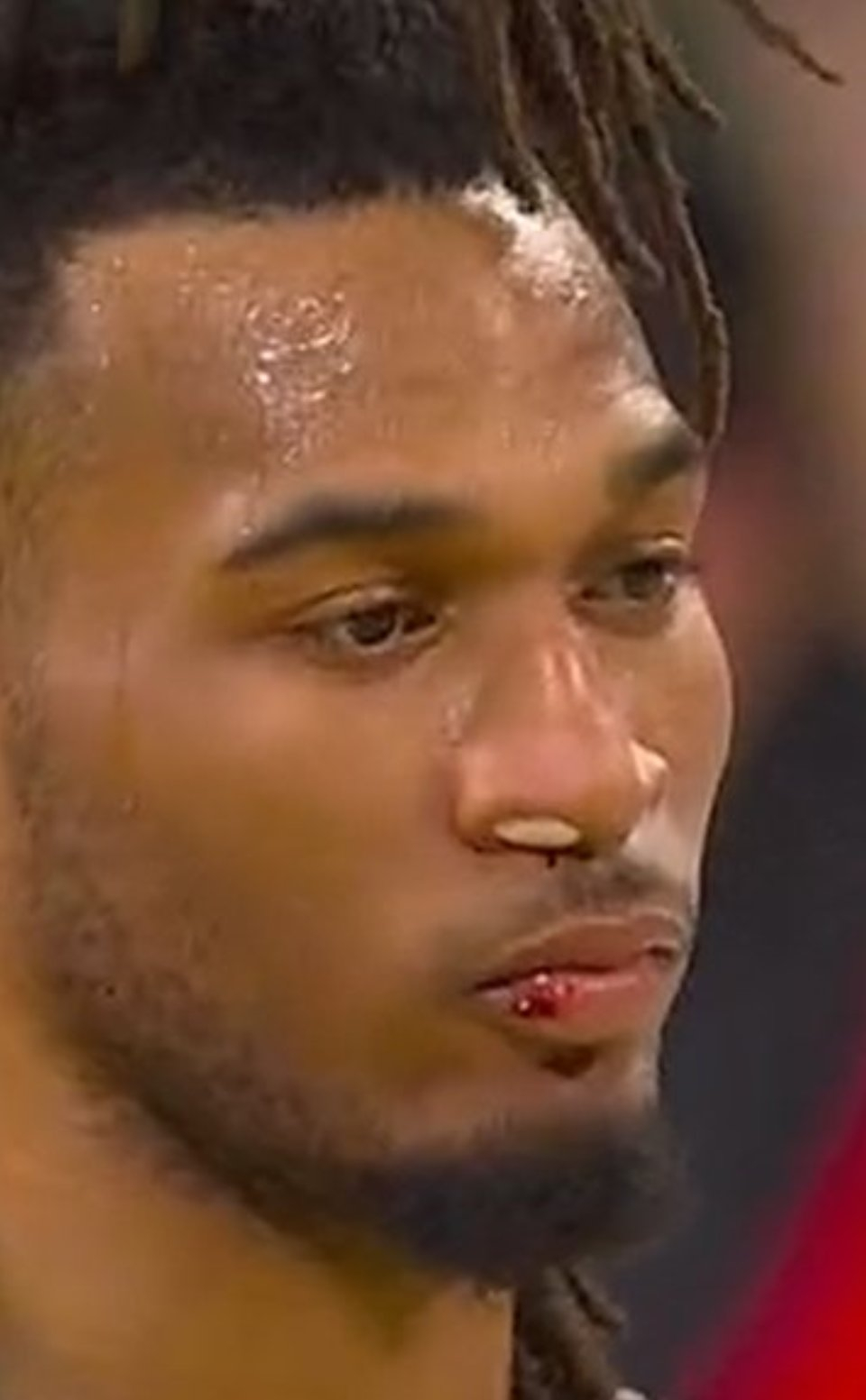 卡斯尔这鼻子是被谁肘的呀？nba