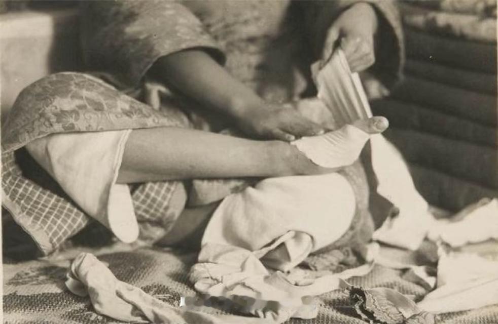 中国有些奇葩习俗真是让人匪夷所思。就说裹脚，要是能把手裹成这样就更美了，女性被迫