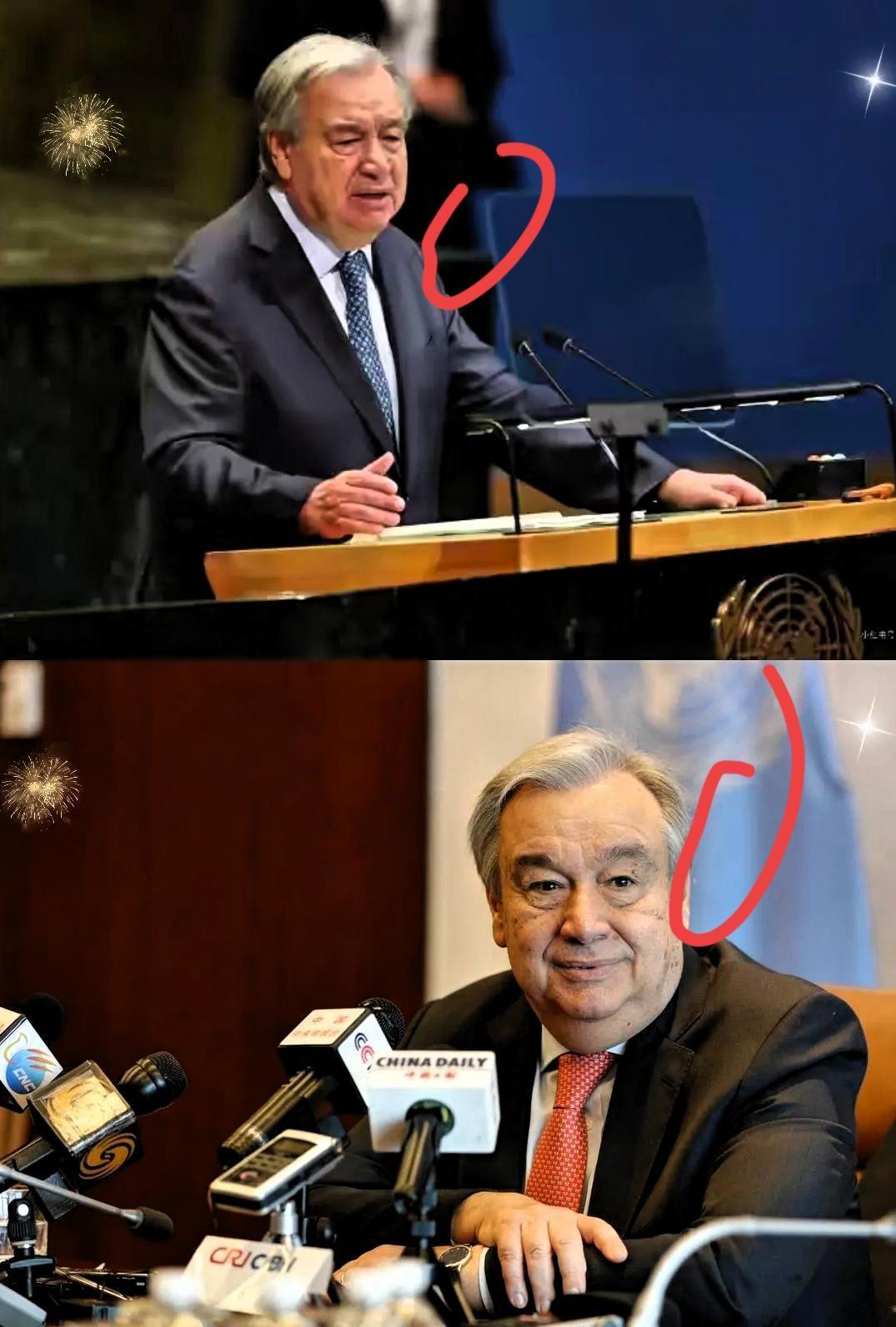 这一巴掌，虽迟但到，打得那叫一个清脆！古特雷斯在联合国当众戳破谎言，直言二战源头