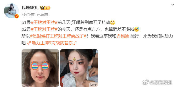 娜扎牙肿到像开了特效娜扎牙龈肿到像开了特效[裂开] 网友纷纷说差点​​​认不出这