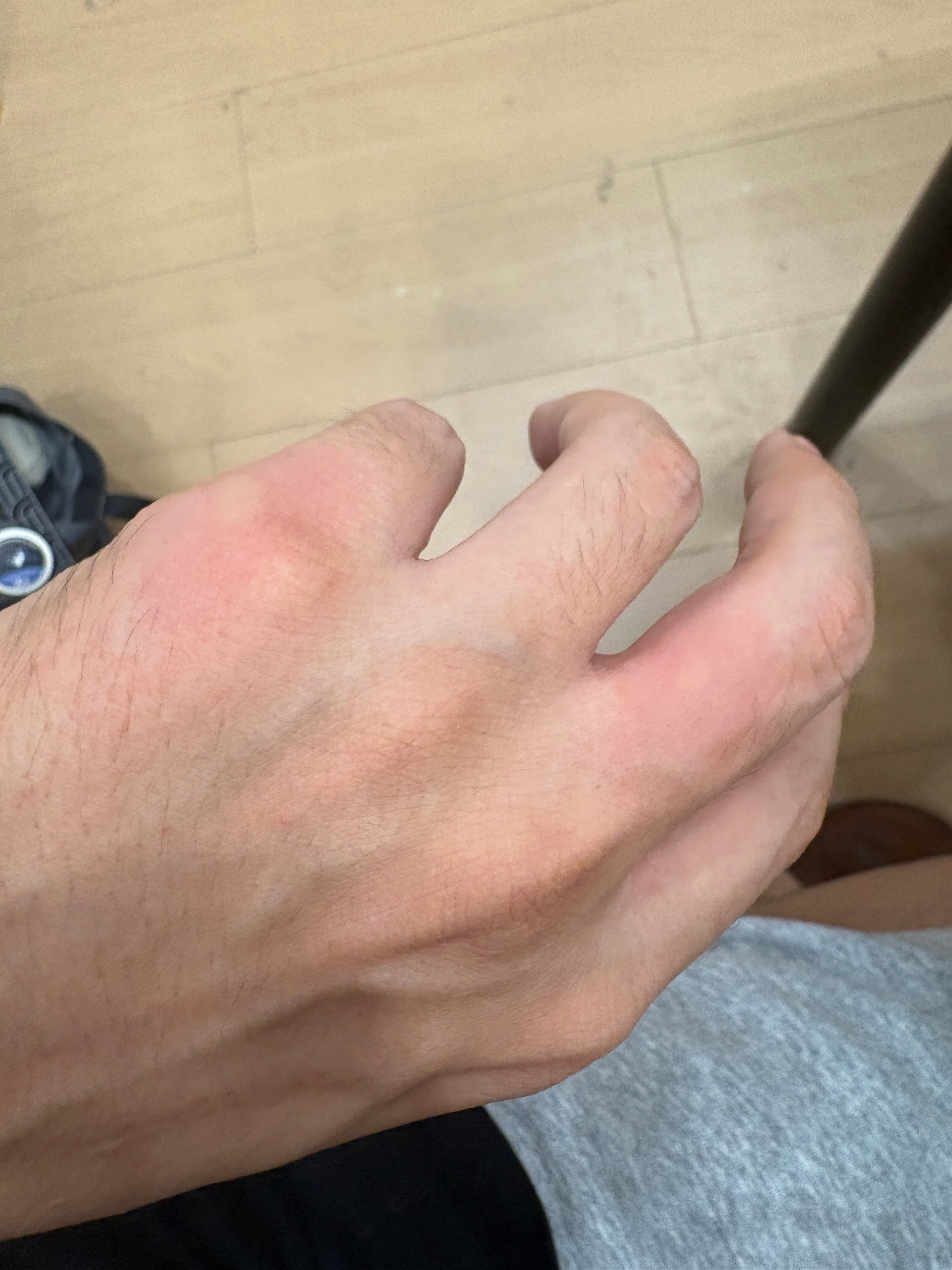 五分钟两个包！也是给我些面子了