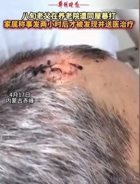 “必须严惩！”内蒙古赤峰，女子将父亲送到养老院，几天后去接，只见父亲裤子直接裂开