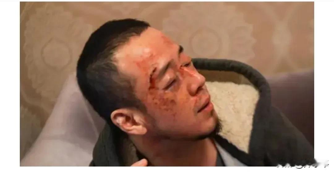 网上传出一张照片，杨坤在长沙演出结束后，在返回酒店的途中，被人拦住，遭遇一顿胖揍
