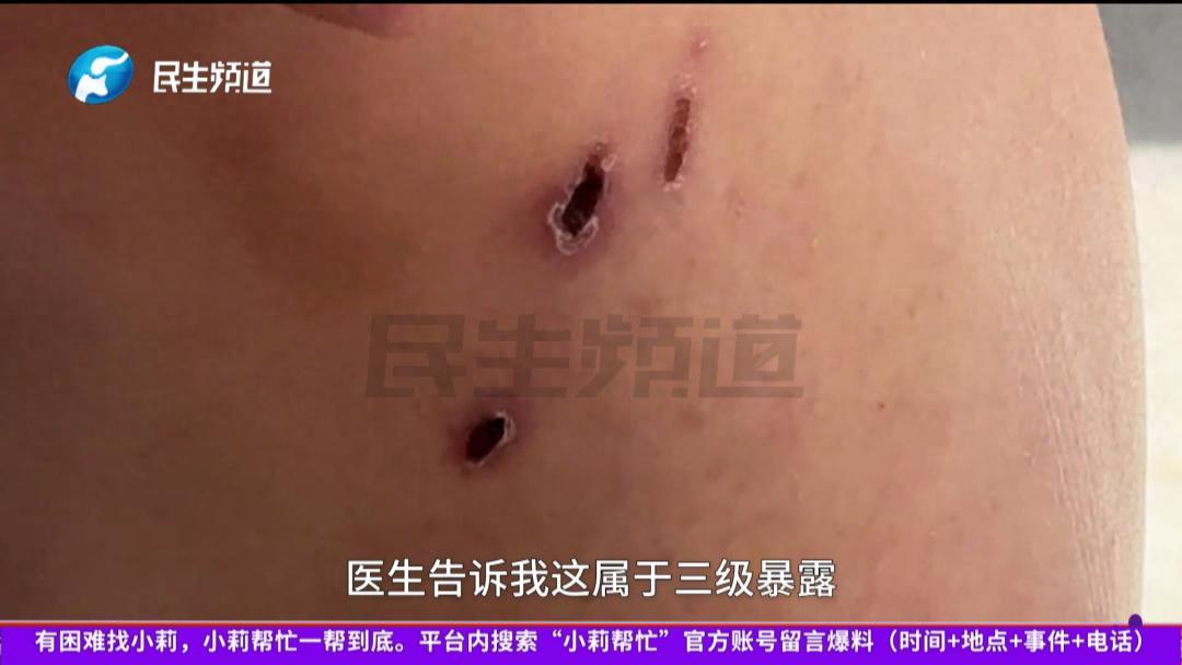 “实在蹊跷！” 天津一名女子看到车前趴着一只像是受伤的流浪小狗，以为是别人走丢的