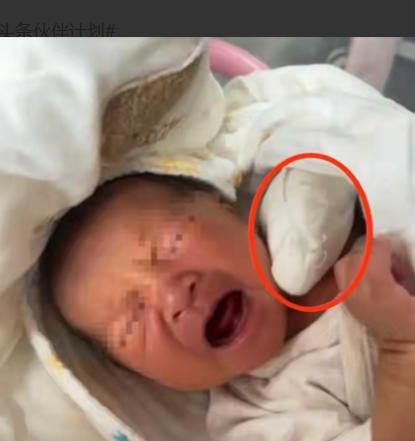 “彻底解释不清！”江苏，盛先生正沉浸在喜得贵子的幸福中，不料助产士上前剪脐带时，