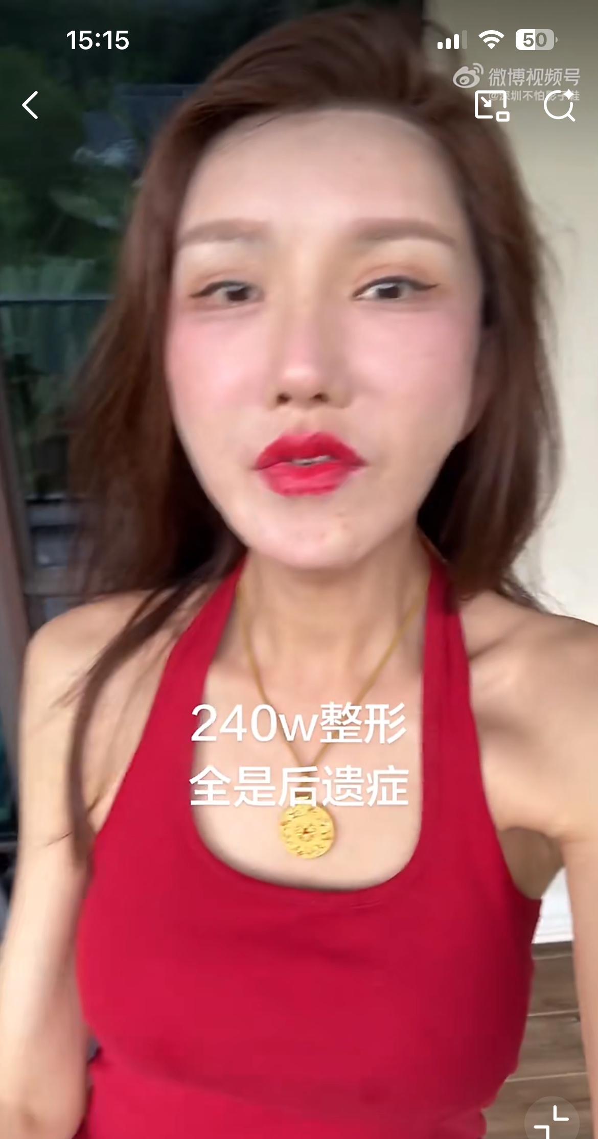 这个变性美女声称花了 240 万美做医美，如今落得个人不像人鬼不像鬼，实际她的整