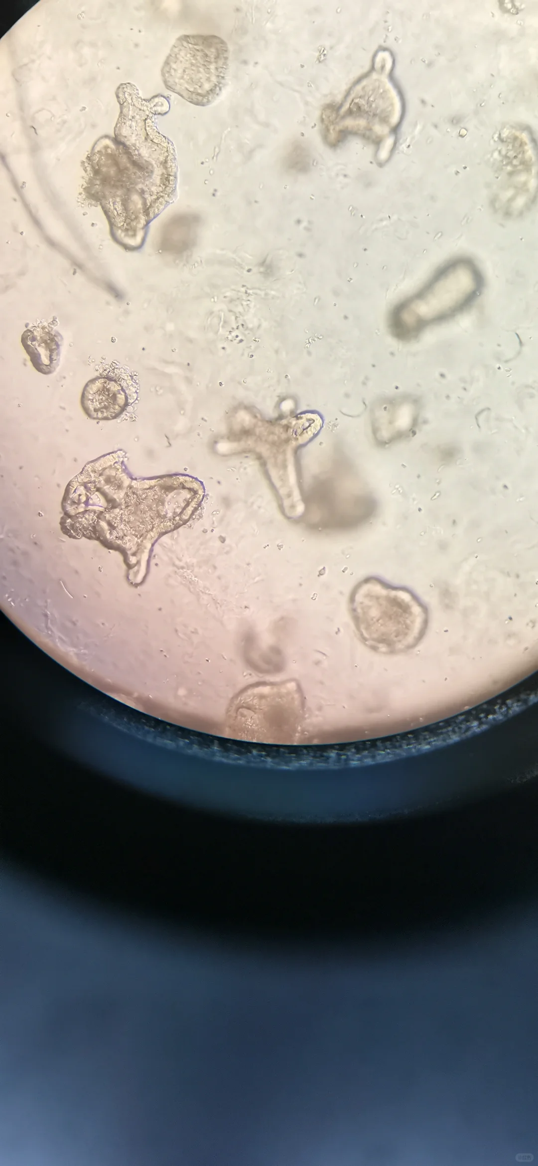 小鼠结肠不会出芽？？？？