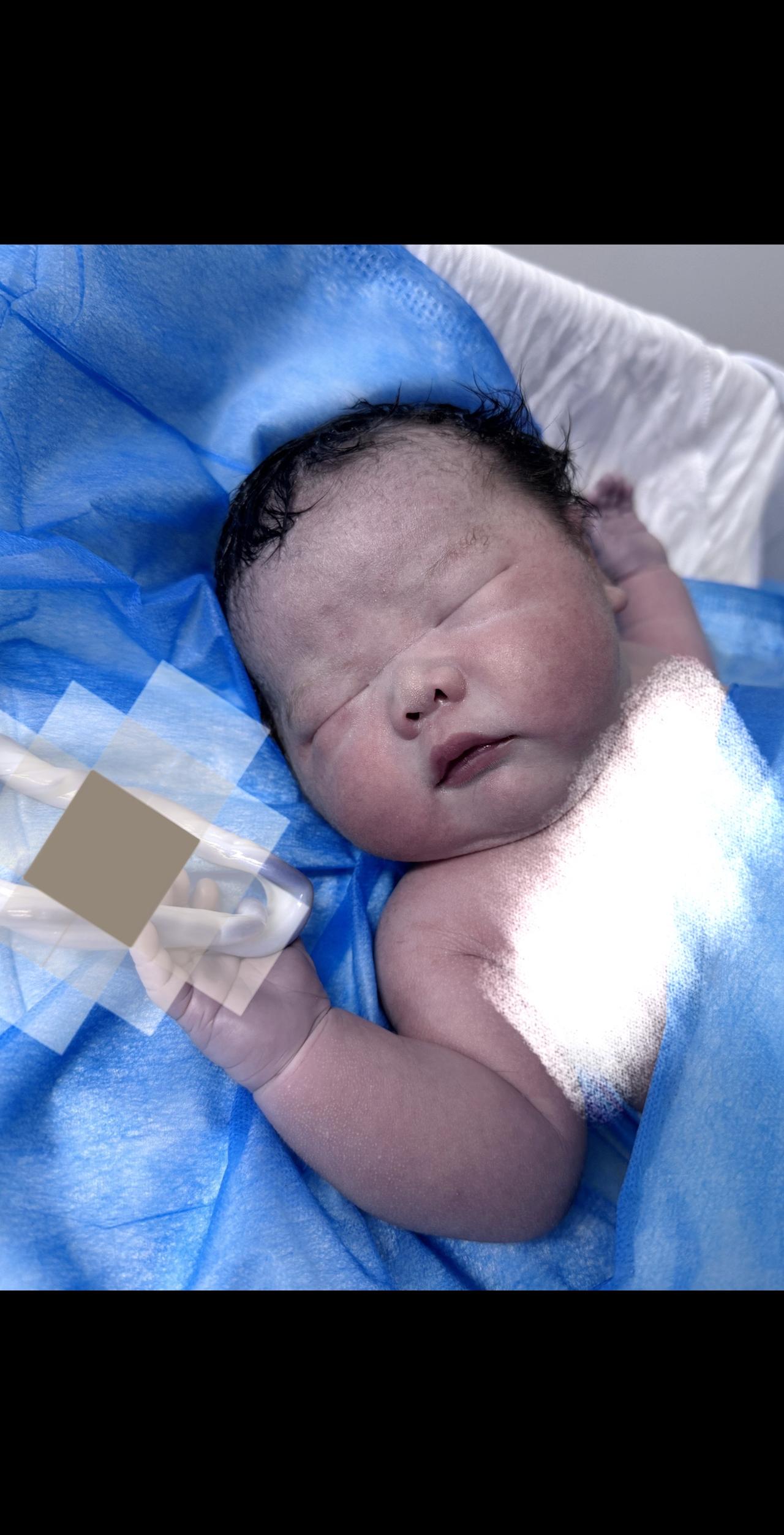 恭喜小宝贝们出生了🎉
愿你们健康快乐成长💗母子平安