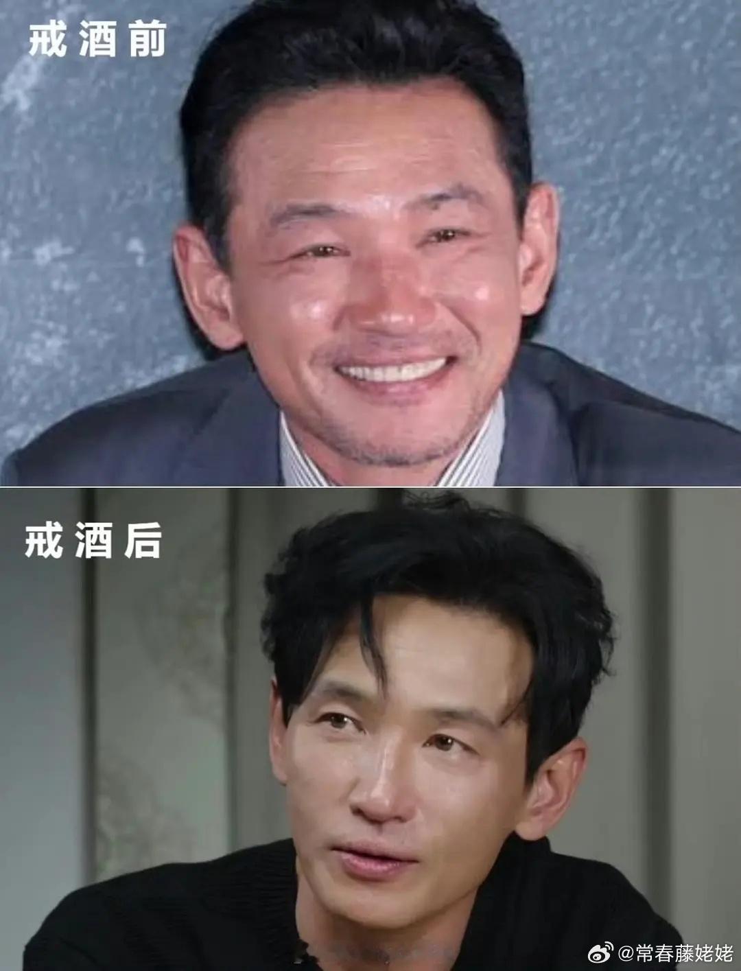 酒糟脸真的很明显，常年喝酒的人，脸一定是肿的，发红发肿，眼神还会有呆滞。 