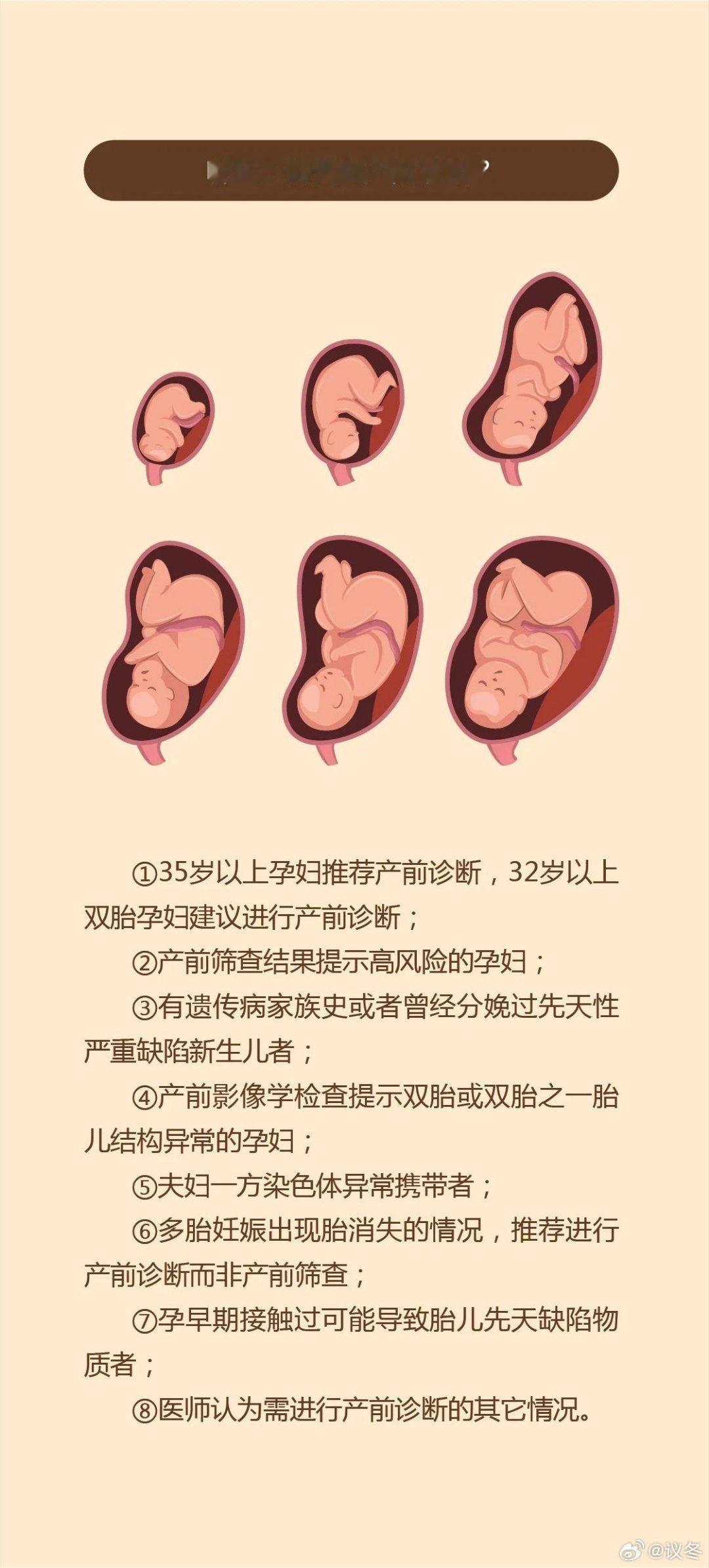 怀双胞胎1个流产1个105天后出生双胞胎一胎不幸流产，另一胎独居宫内105天后奇