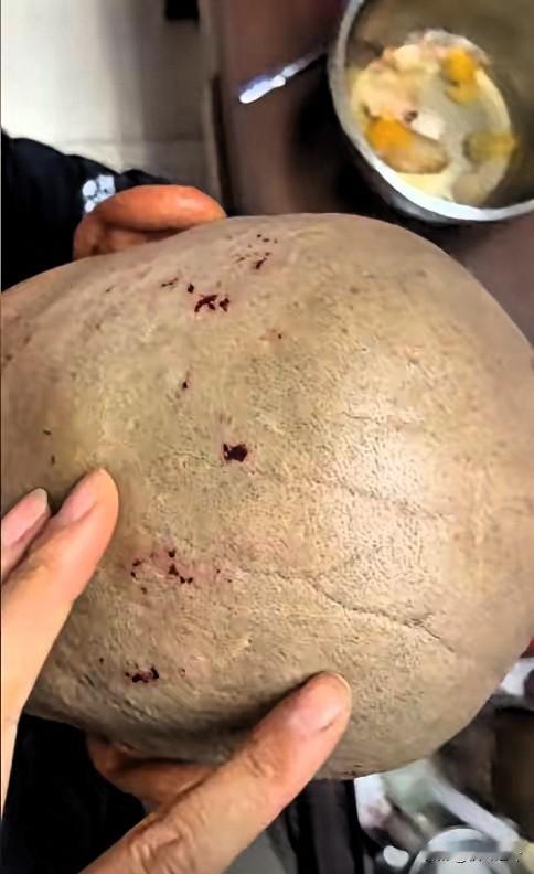 近日，天津一大爷花 10 元剃头，结果满头都是伤口，回家女儿又气又心疼，当场就要