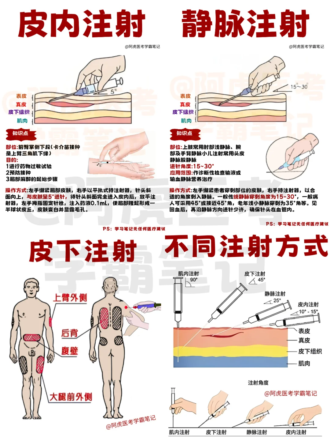 医学生笔记📒：4种注射技能总结！👆