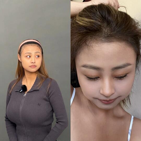 头发全部都长出来啦❗️疑问解答贴😜