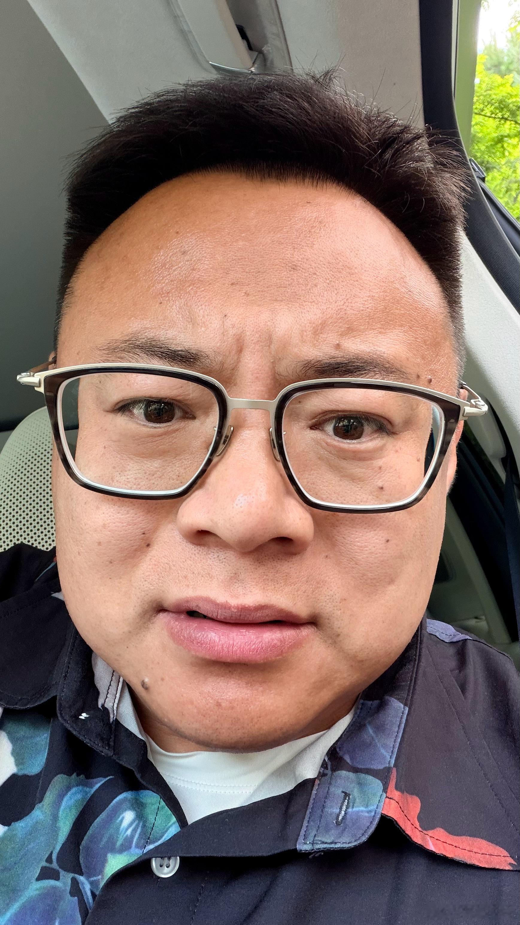 还没盛夏呢我最近被晒的黑色很印度人一样我有点恶心我准备再黑一个色度  正常一点 