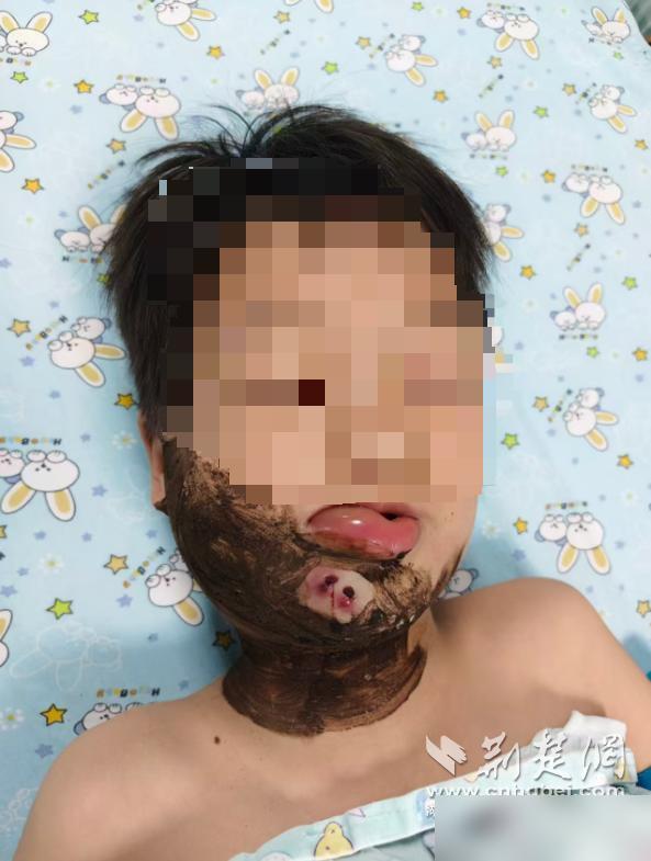湖北襄阳，一8岁男童傍晚在汉江浅滩踩水嬉闹时，一条黑影猛地从浑浊水面窜出直扑其面