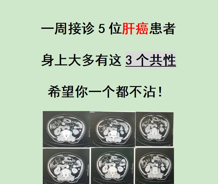 这周接连接诊了5位年轻肝癌患者，最小的31岁，最大的也才46岁，都是正...