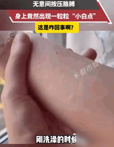 看着太瘆人！

河南这网友的经历我看着也浑身发紧，去年我家孩子胳膊上也出过一模一