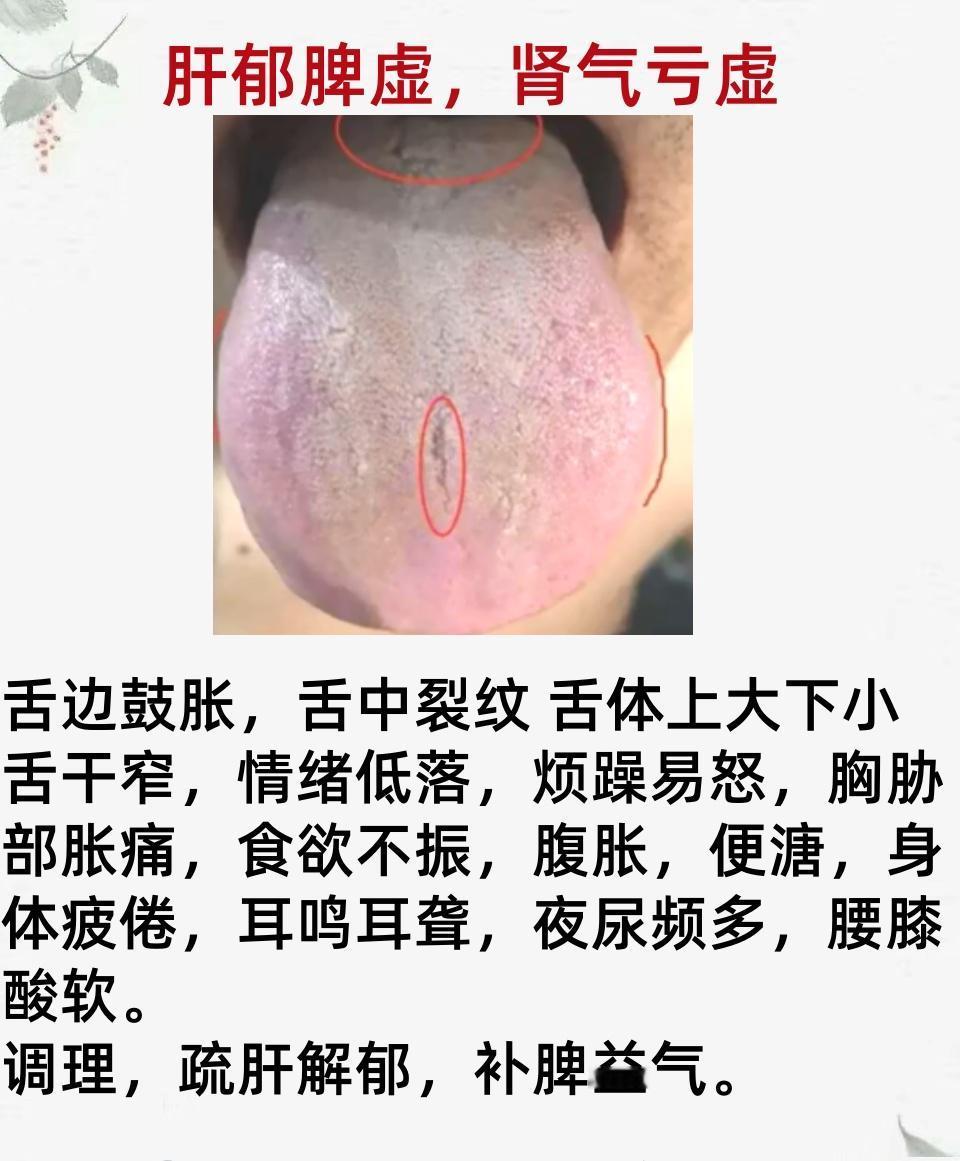 朋友们，大家好啊，新的一周开始啦，
今天继续舌诊挑战，今天是第16天，这个月争取