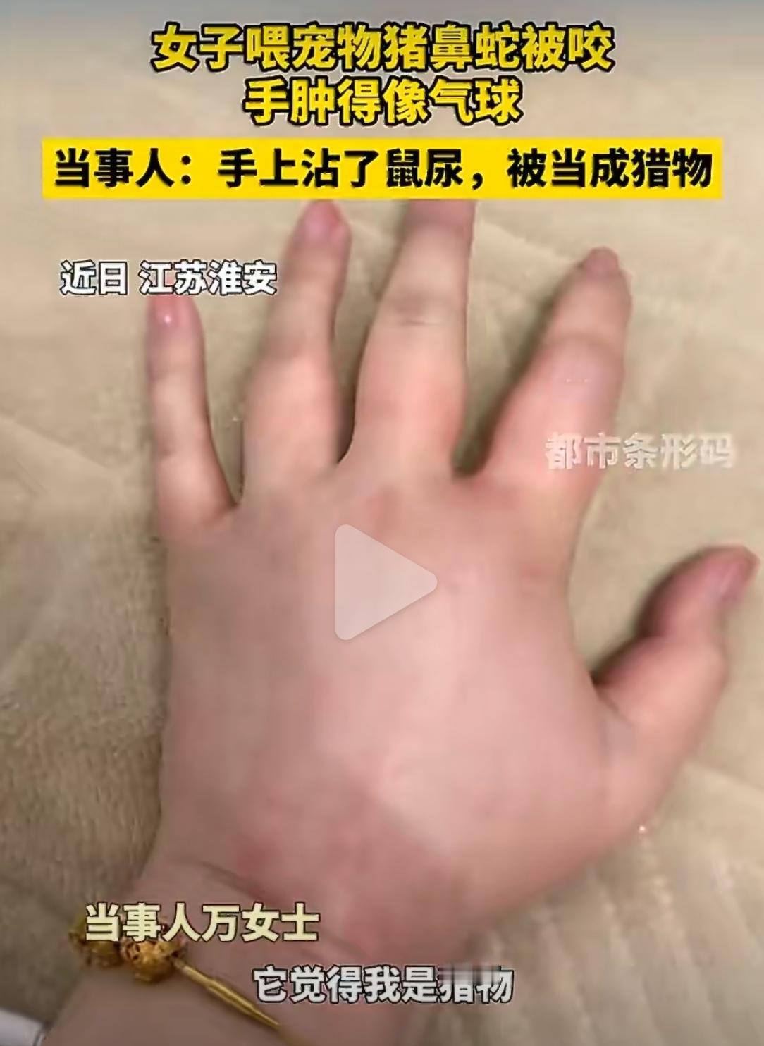 江苏淮安一女子喂宠物猪鼻蛇，手上沾了老鼠尿，结果被蛇当成猎物猛咬一口。半小时后，