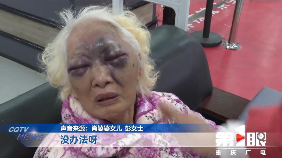 “悲剧还是发生了！”10月24日，重庆，一81岁老太去超市买东西，由于没看到超市