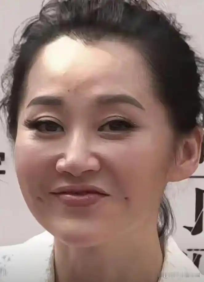 许晴亮相活动整体状态尚可，可下巴与苹果肌观感略显僵硬违和，夸张的假睫毛格外抢眼，