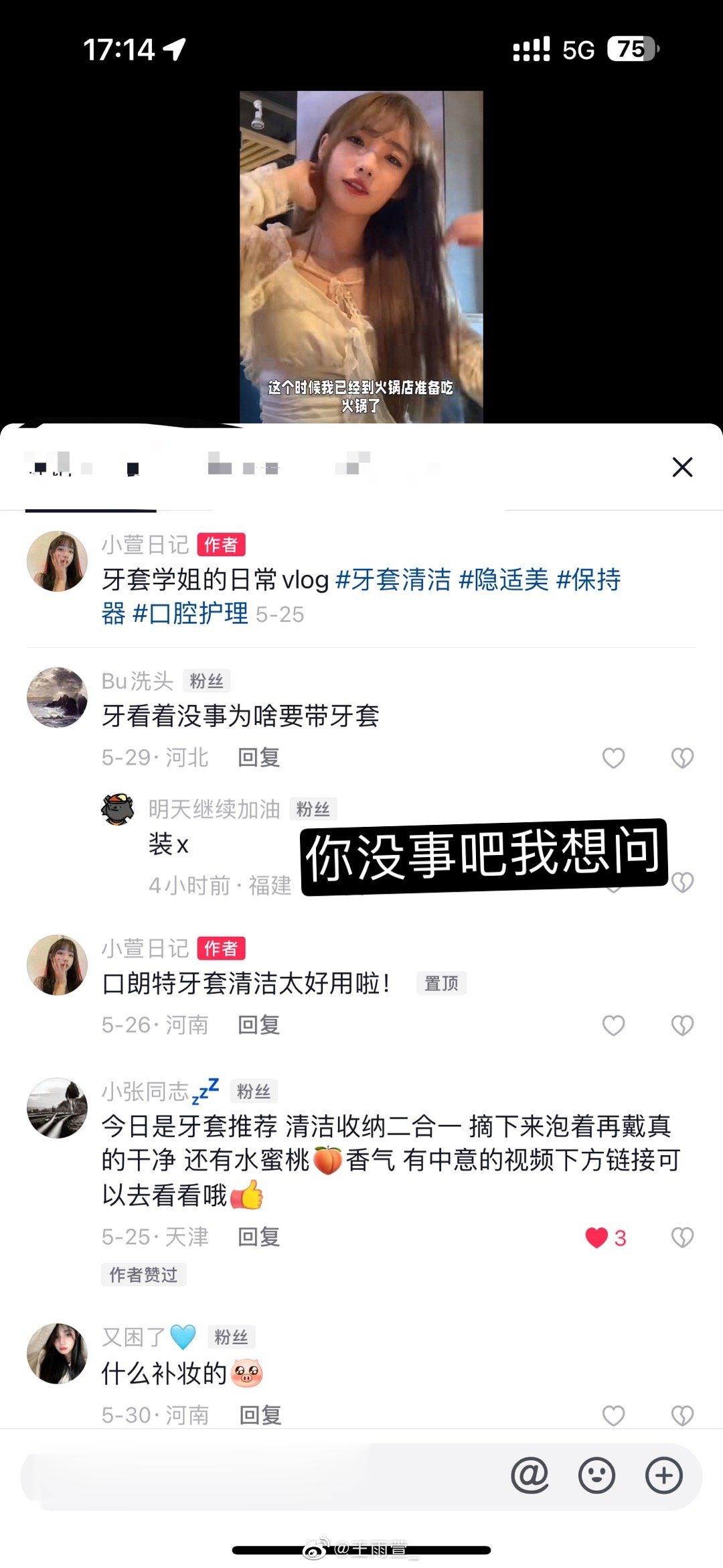 带牙套有啥装x的？？我一点不想带牙套[微笑] ​​​