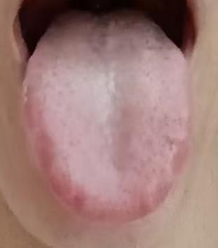 湿热蕴结下焦，气血运行受阻，宗筋固摄难以稳定






不少粉丝留言倾诉：近一