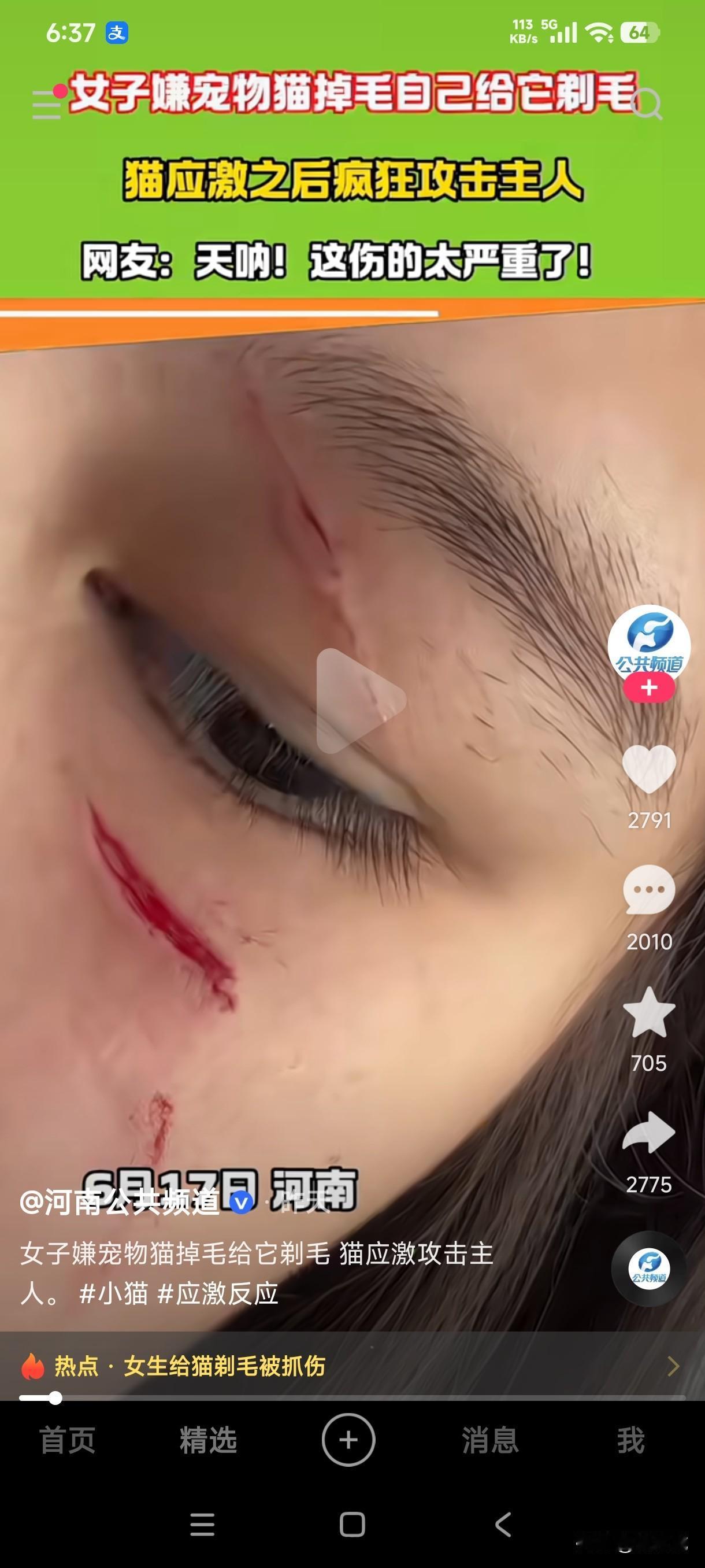 女子嫌自己养的宠物猫掉毛给它剃毛，没想到猫应激以后疯狂攻击她，居然被猫抓的伤痕累