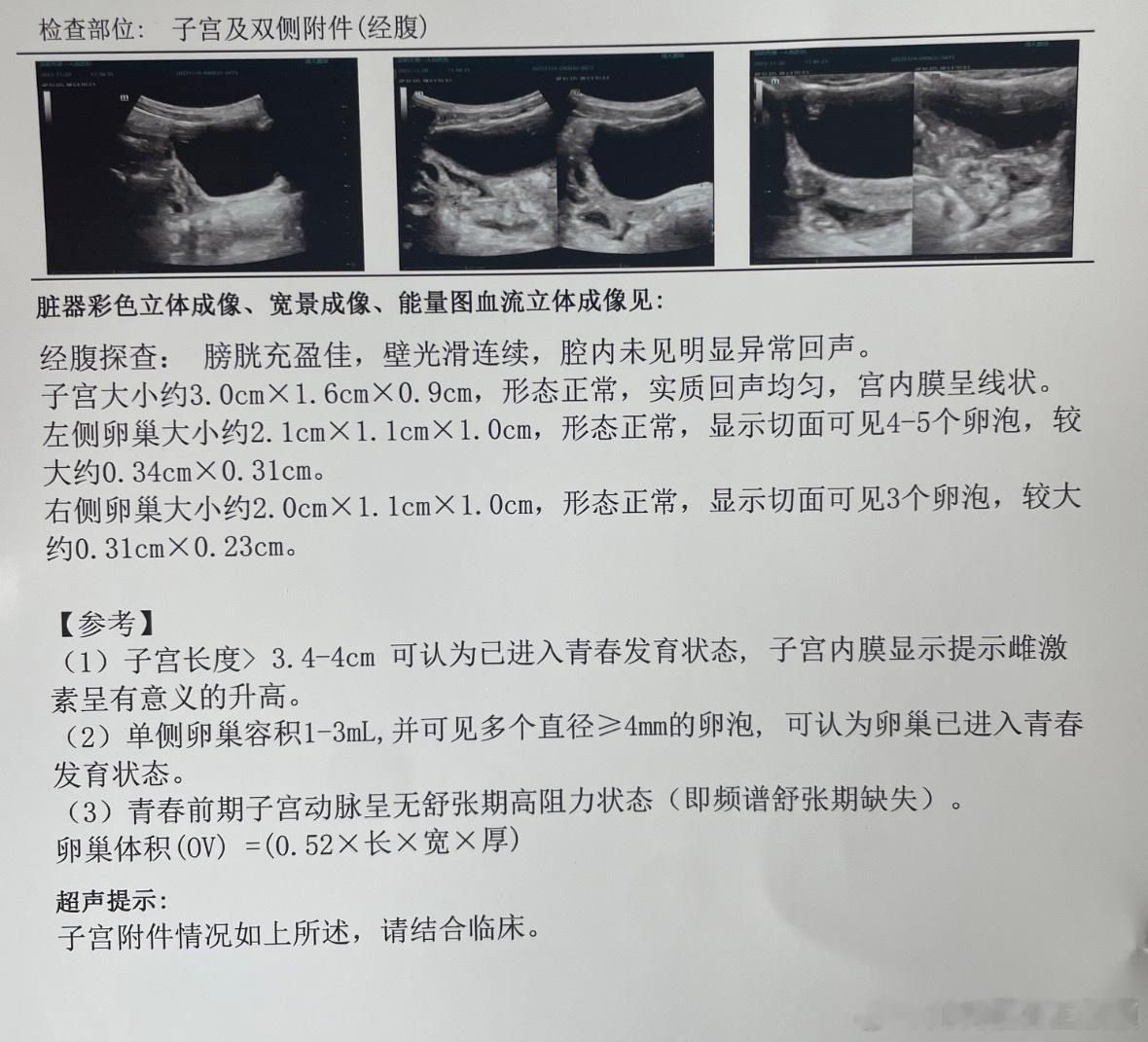迄今为止，看到的一份最满意的超声报告，把性早熟和早发育娃的子宫卵巢卵泡发育，描述