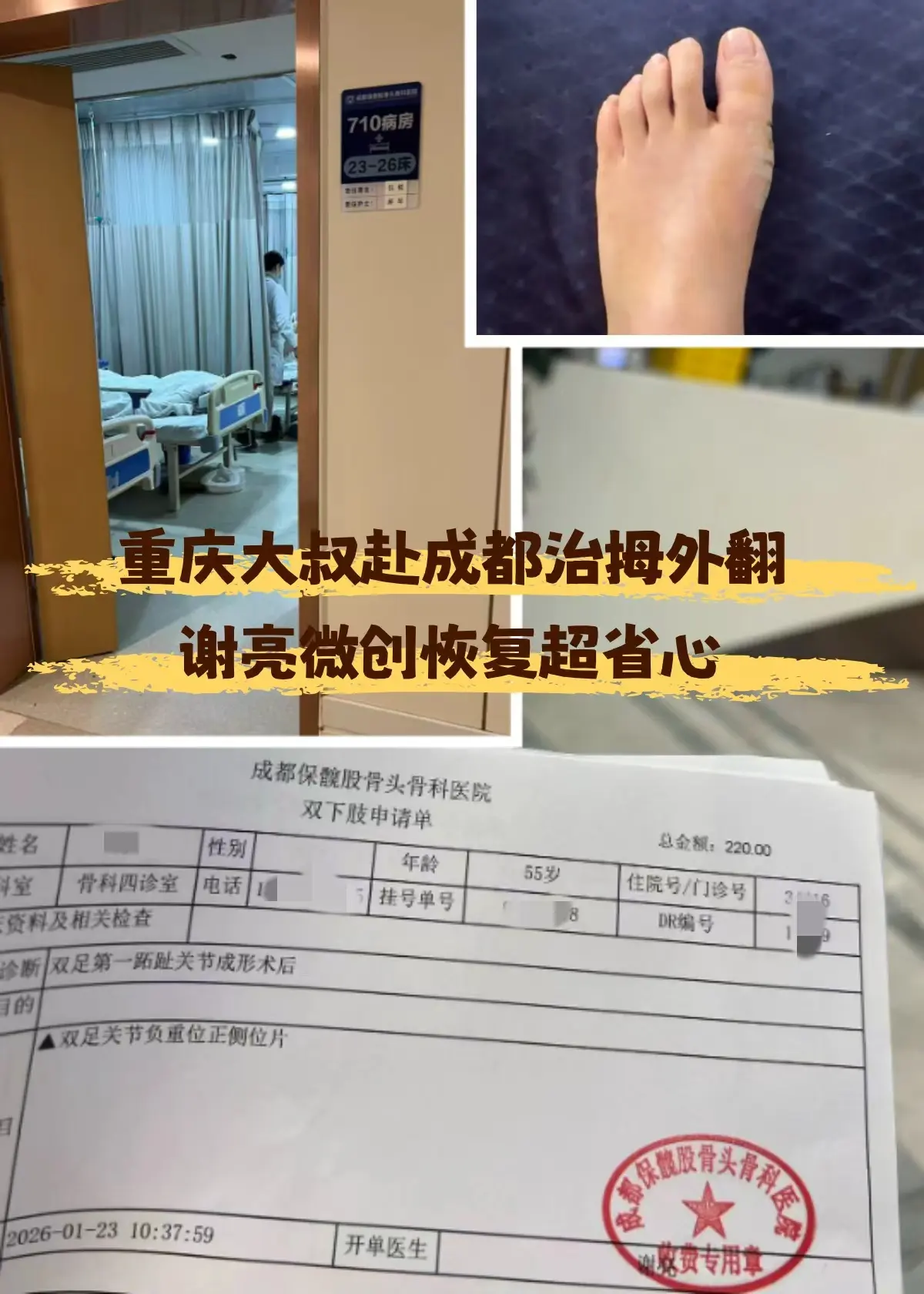 重庆大叔赴成都治拇外翻，谢亮微创恢复超省心 我今年46岁，重庆做小生意...