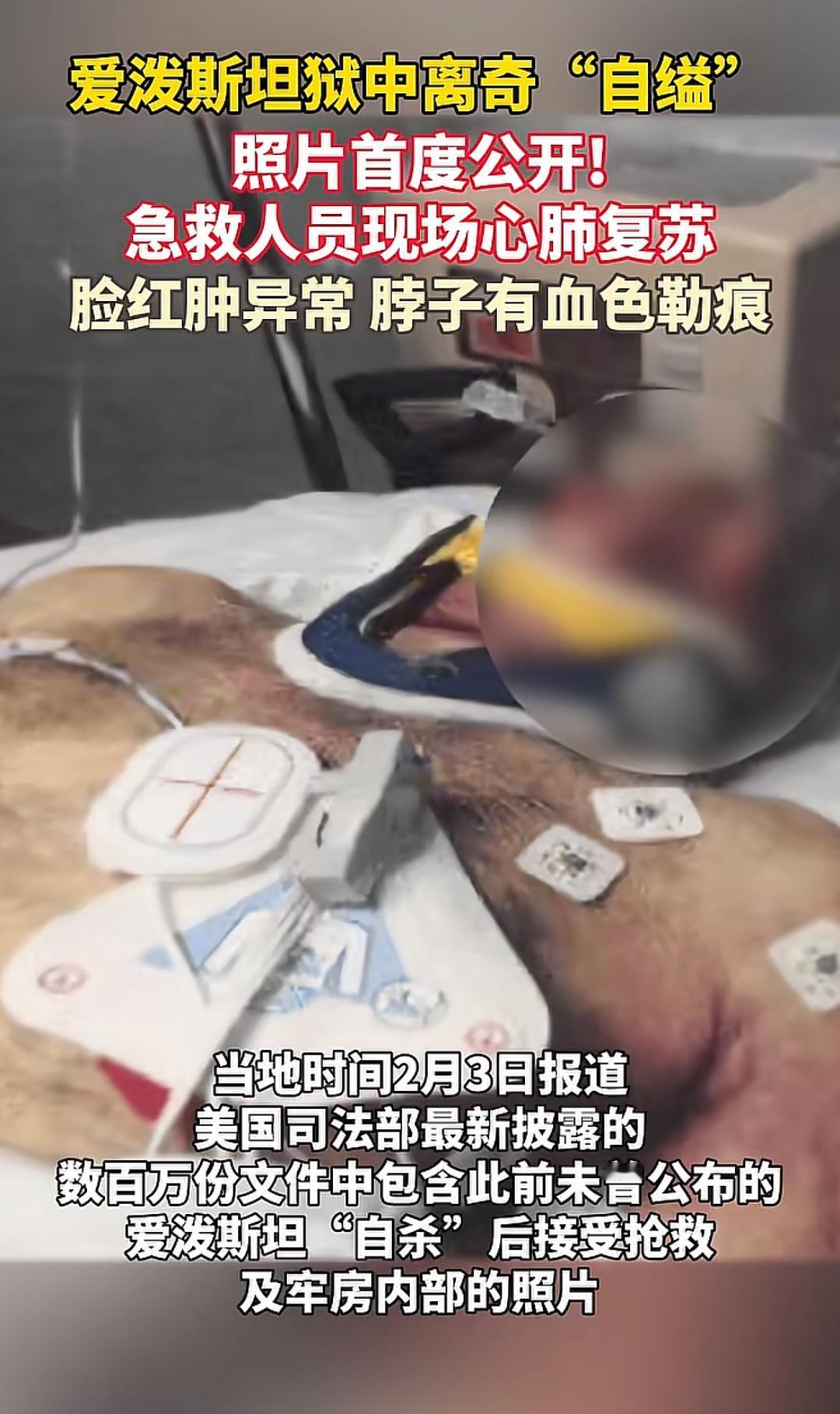 狱中离奇"自缢"，照片首度公开！急救人员现场心肺复苏，脸红肿异常，脖子有血色勒痕