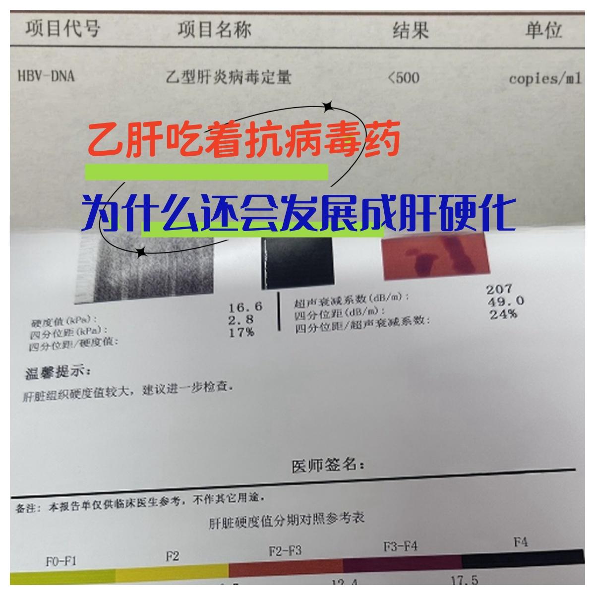 为什么吃着抗病毒药，还会发展成肝硬化？。在临床上有些乙肝患者明明在进行...