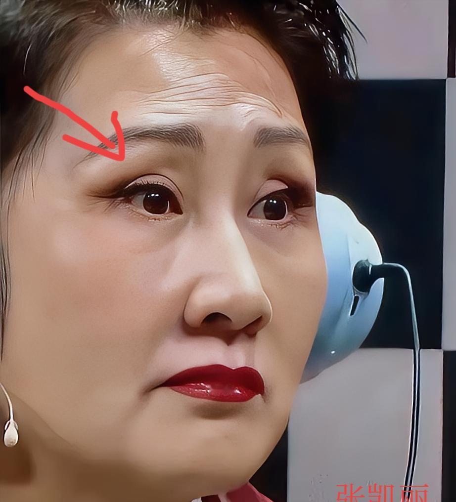 张凯丽年轻时，剧组化妆师说她的双眼皮褶子能夹住火柴棍。
现在机场被拍，眼皮耷拉