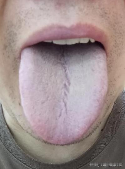 大哥这真是五毒俱全，关键是你还不自知[狗头][狗头][狗头]
主诉：腰腿发凉， 