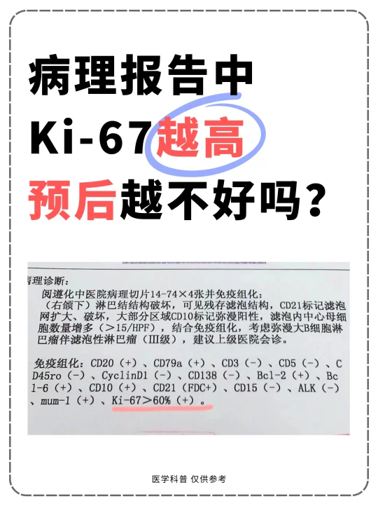 病理报告中ki67越高，预后越不好吗？