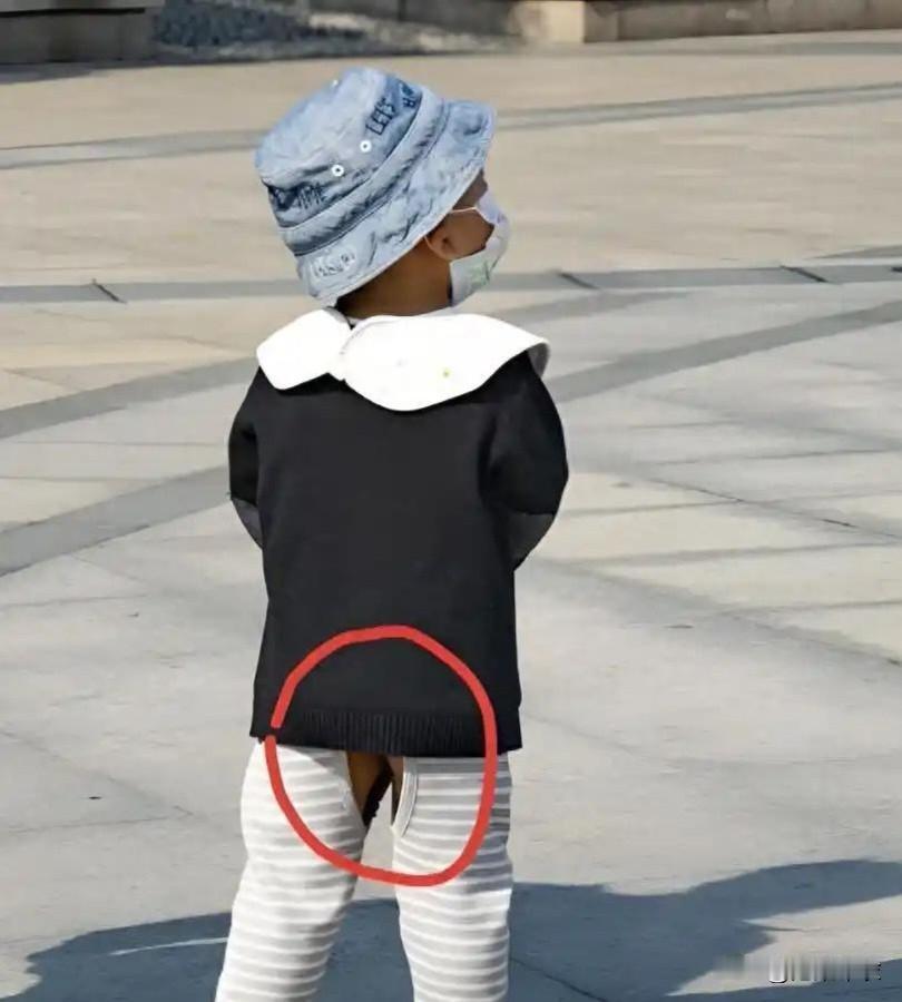 你问我答小孩的屁股有三把火是真的吗，他们大冬天怎么穿开裤？