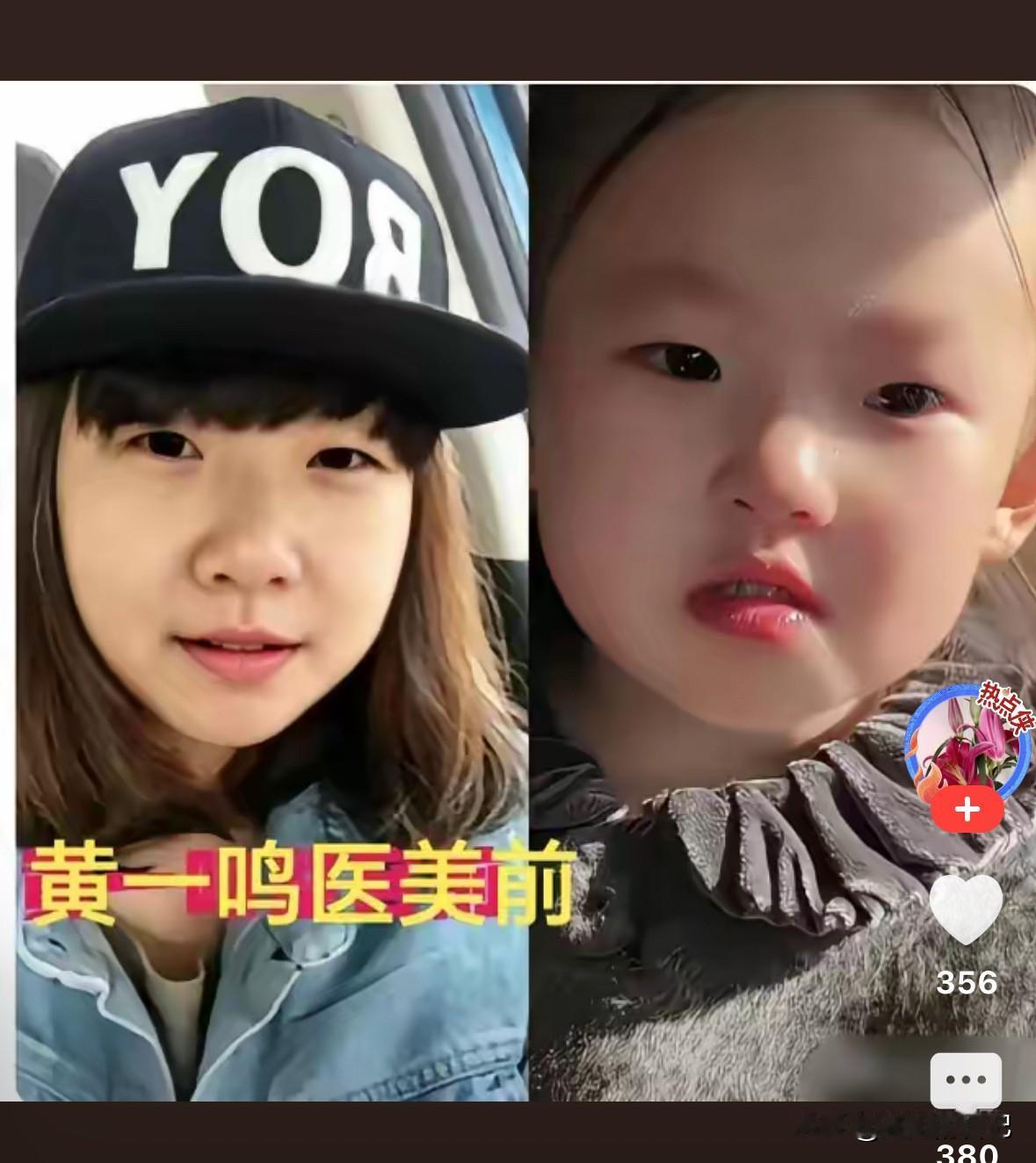 黄一鸣说2021年的时候，她还是纯天然，现在已经26岁了，女人过了25岁，就要➕