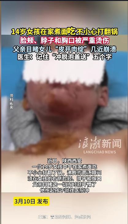 “悲剧还是发生了！”近日，陕西西安，一14岁女孩在家煮面时突发意外，把锅给打翻了