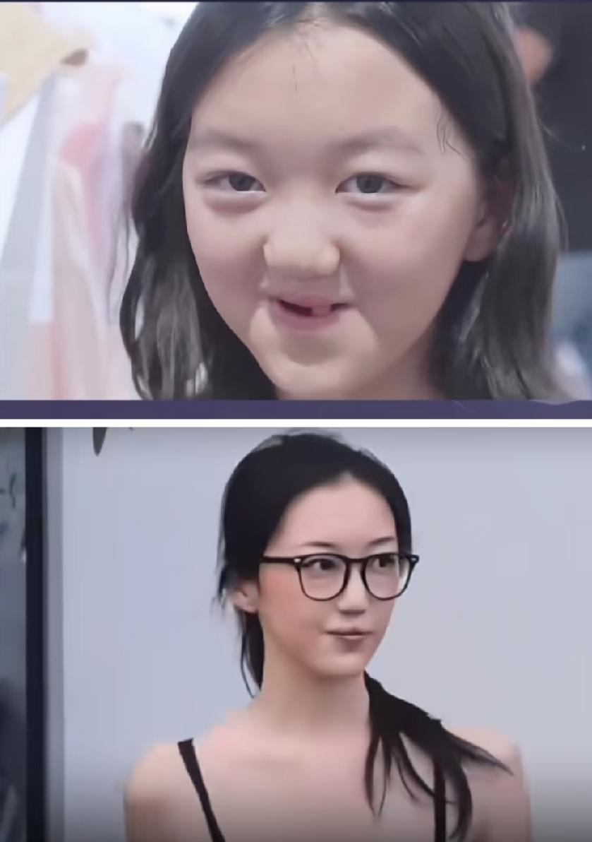 总体来说李嫣是幸运的，这要是放在普通人家，怎么能恢复得这么好，妈妈有钱，爸爸负责