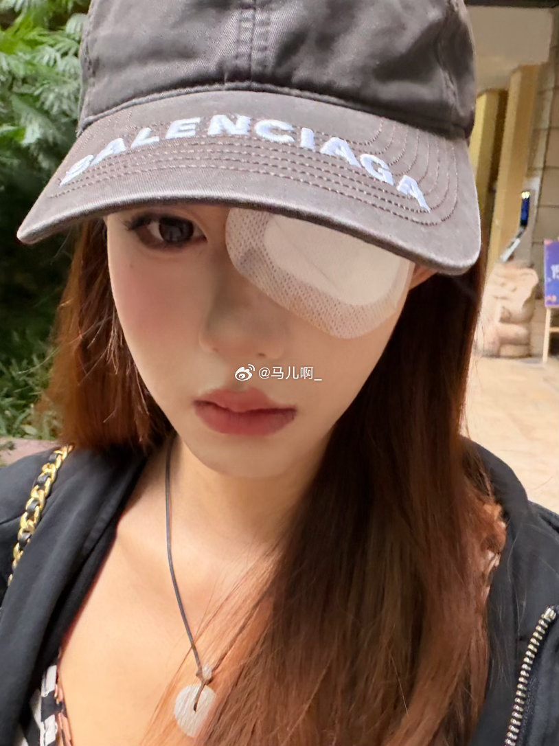 我真是没招儿了[泪奔][泪奔][泪奔]我恨蚊子！！！！！ ​​​