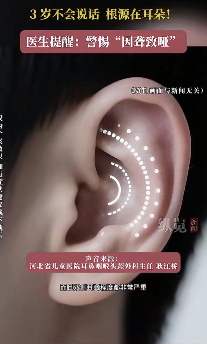 3岁娃不会说话，家长一直觉得是"贵人语迟"!一查竟是全聋，医生痛心：你们耽误了他
