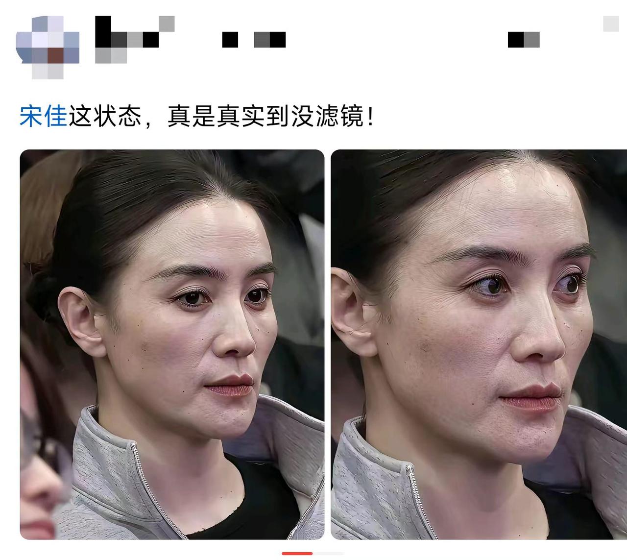 这法令纹，是不是深了点？