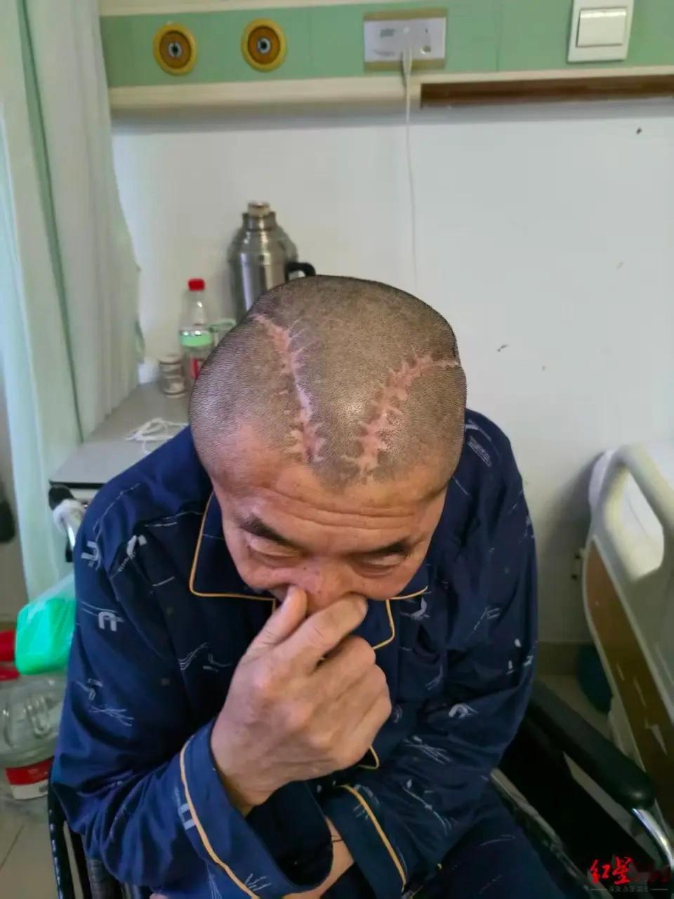 右病左开令人忧，

错将左脑当右修。

两次受苦家属愁，

赔偿追责盼公道。