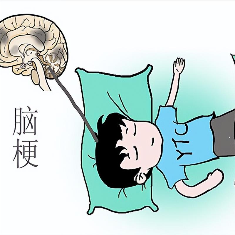 身体出现这3个表现，可能是脑梗在逐渐恢复！
 
1. 头痛症状减轻
若是明显感觉