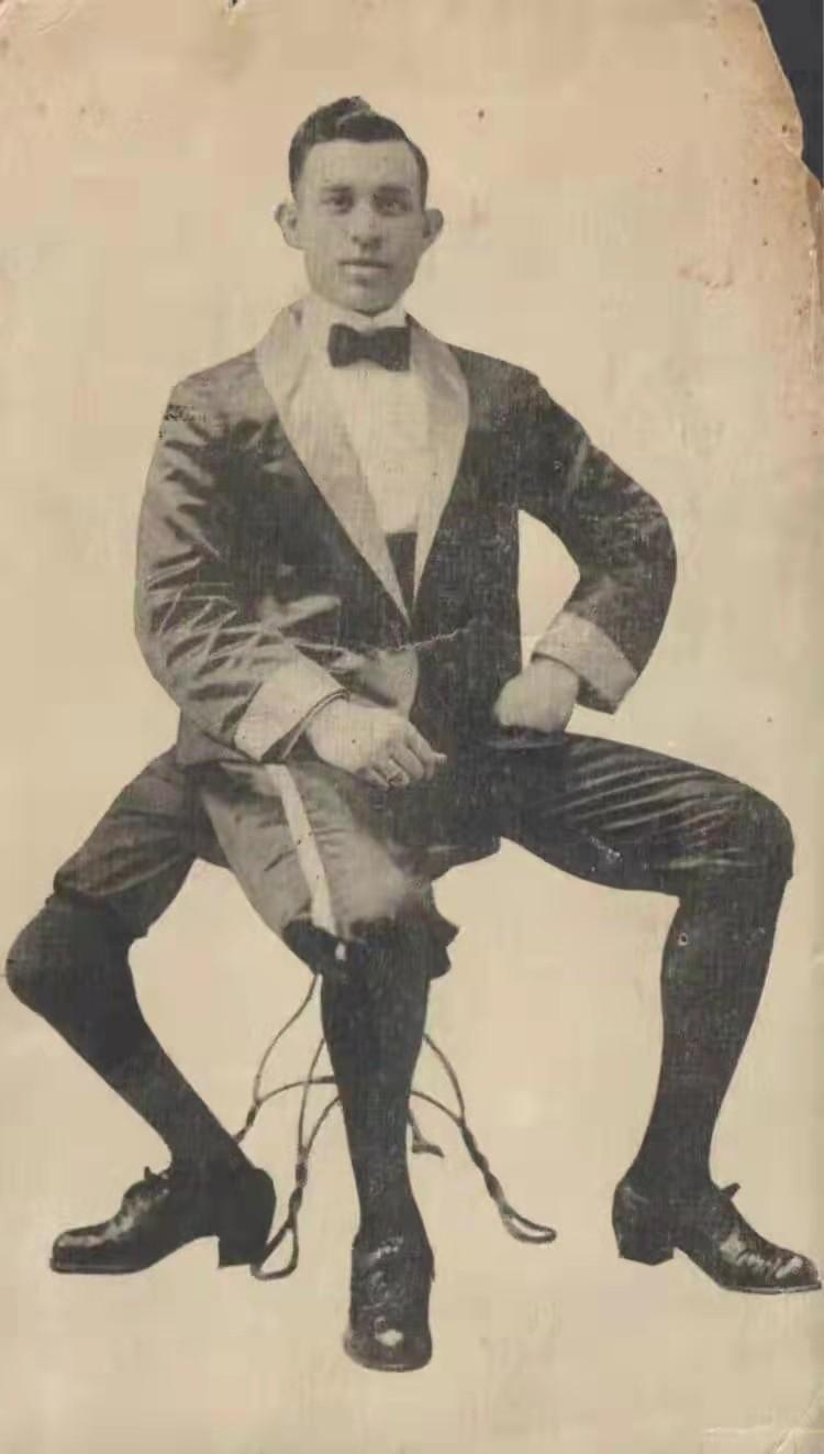 1898年，一个长着三条腿，四只脚，十六个脚趾和两个生殖器的九岁小男孩，从意大利