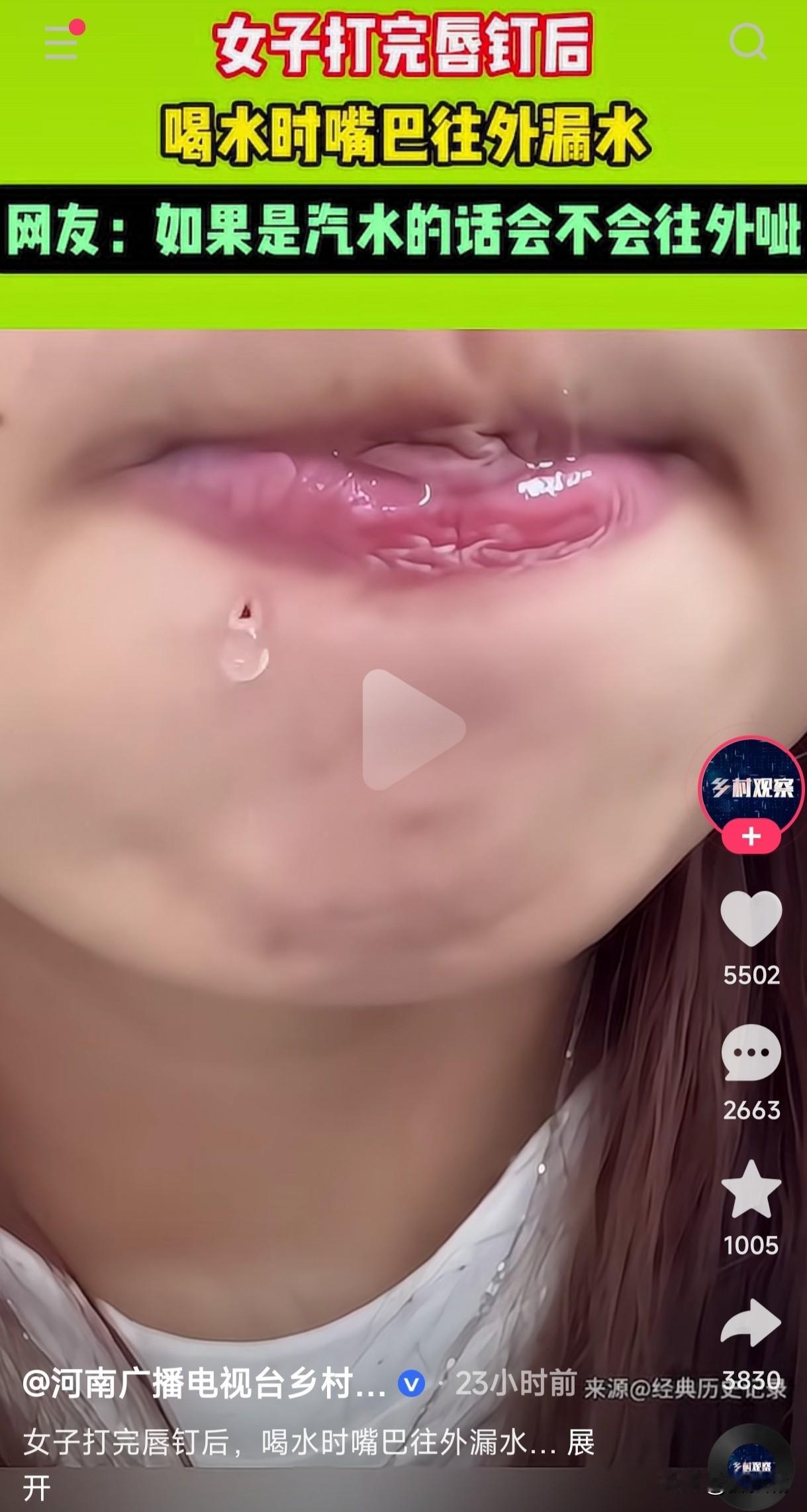 打耳钉是为了戴首饰美观好看，这打唇钉的做法实在是让人不能理解？女子打完唇钉后喝水