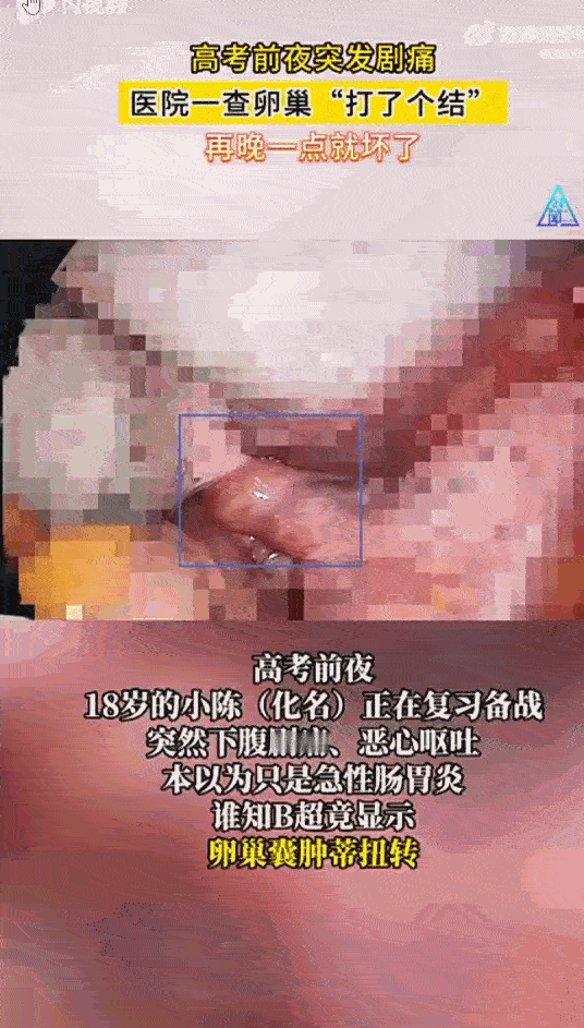 “太吓人了！”广东广州，一名18岁的高三女生正在台灯下为高考做最后冲刺，下腹突然