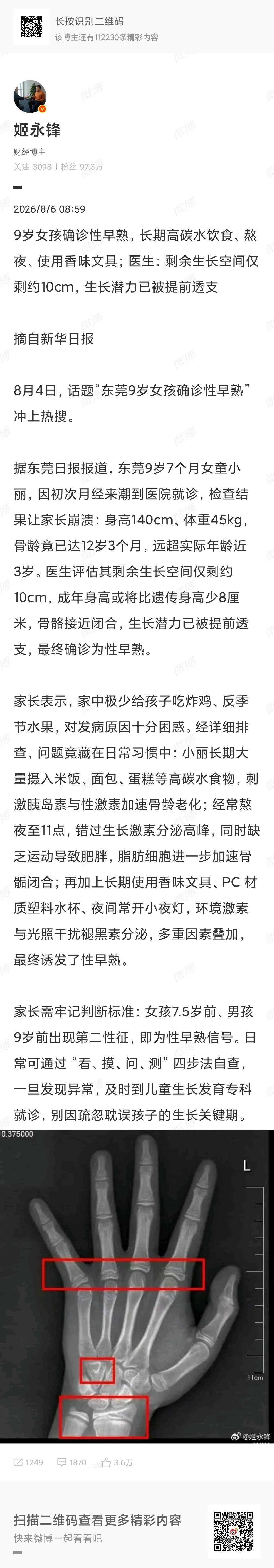 小夜灯 性早熟逻辑归因混乱。小夜灯应该不是关键原因，只有极为微弱的联系，不应该搞